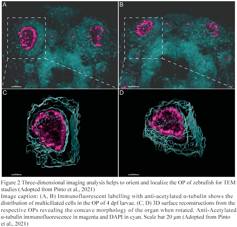 Zebrafish as a Model for Studying Ciliary Development and Disease ...